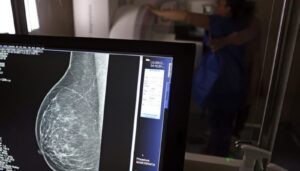 Casos e mortes por câncer de mama podem aumentar em 40% até 2050, alerta OMS