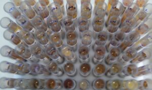 Uso de medicamento oferecido no SUS reduz casos de malária no Brasil